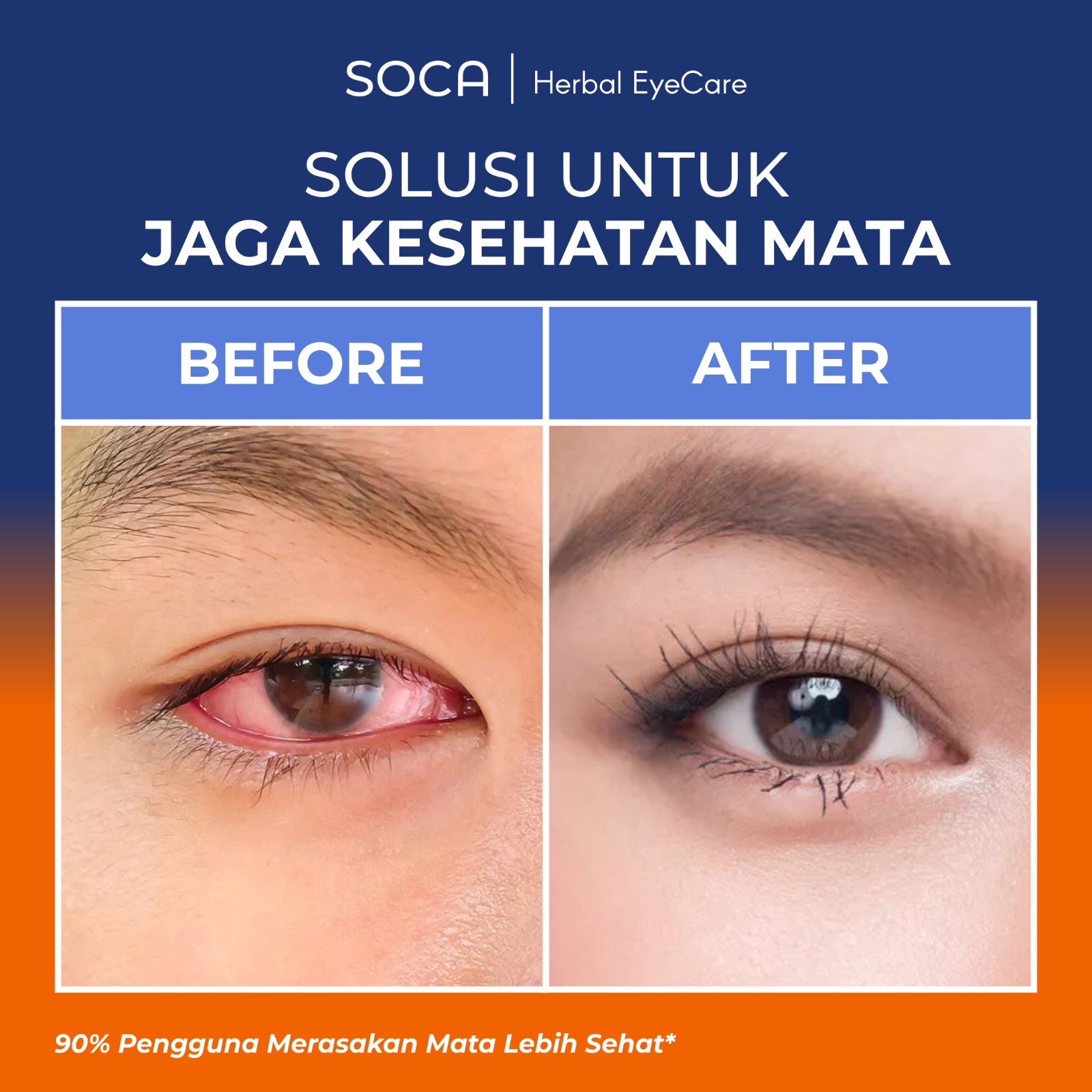Before After SOCA